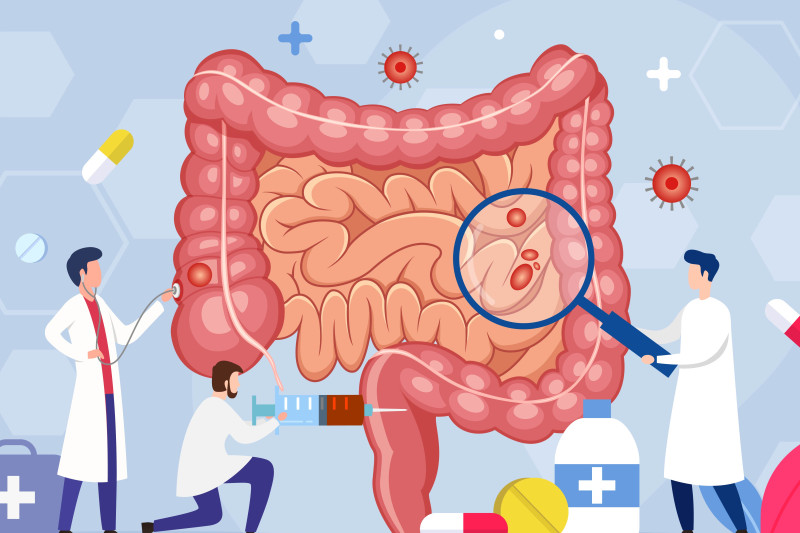 Imagem de Exame Per-Operatório 