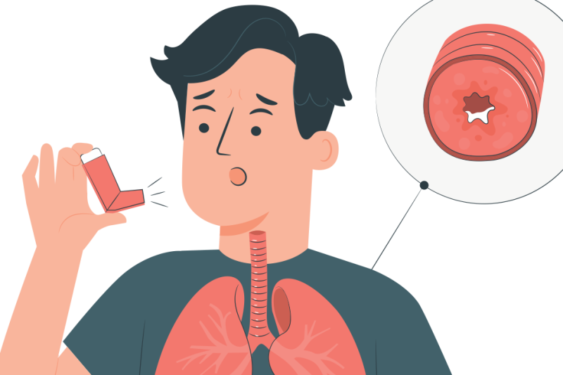 Imagem de Você conhece a Asma Eosinofílica?