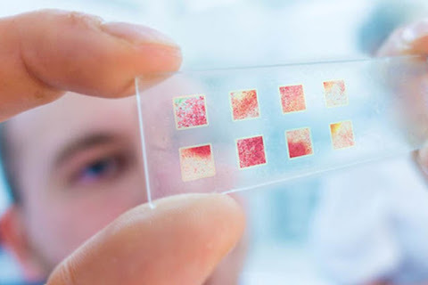 Imagem de Biópsia de Congelação