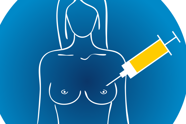 Imagem de Biópsia por Agulha Grossa