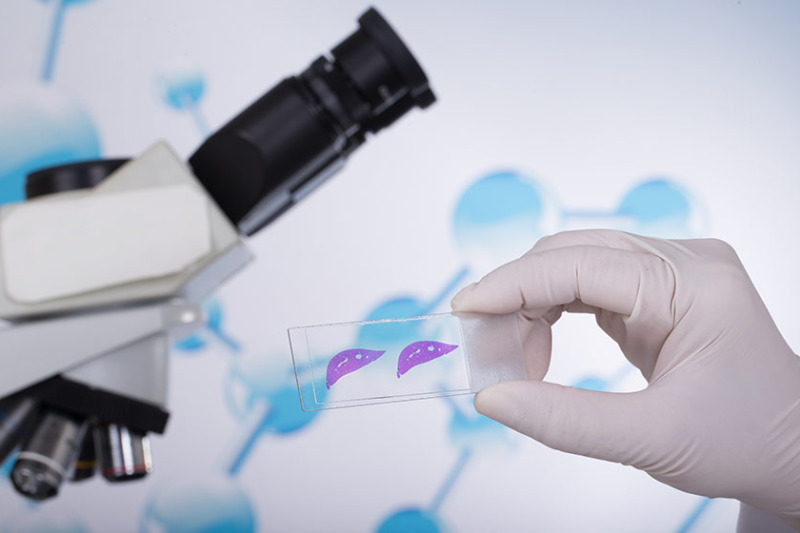 Imagem de Análise da Biópsia de Mama