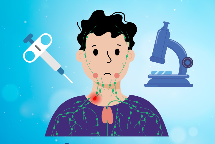 Imagem de Biópsia de Linfonodo