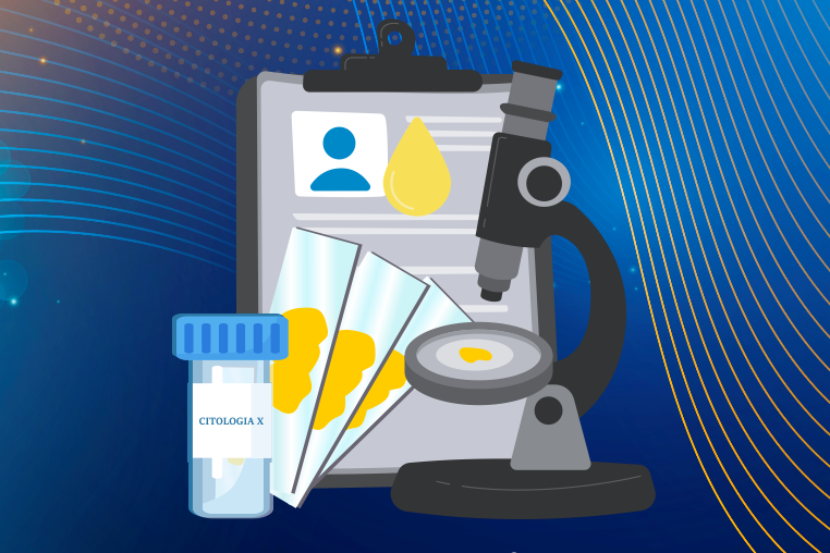 Imagem de O que a Biópsia Pode Descobrir?