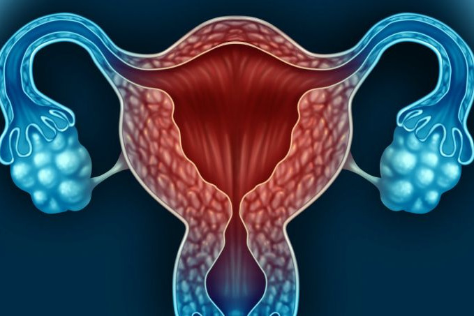 Imagem de Câncer de Colo de Útero