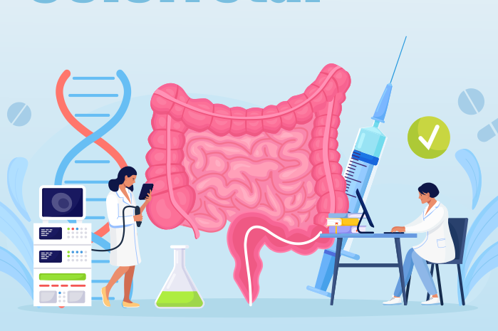 Imagem de O Câncer de Cólon e Reto