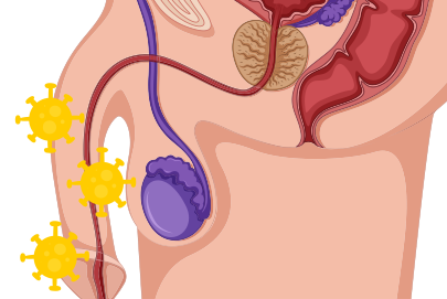 Imagem de 5 Informações Sobre o Câncer de Pênis que Você Precisa Saber.