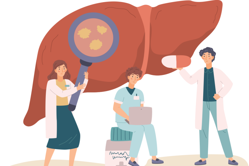 Imagem de Cirrose Hepática 