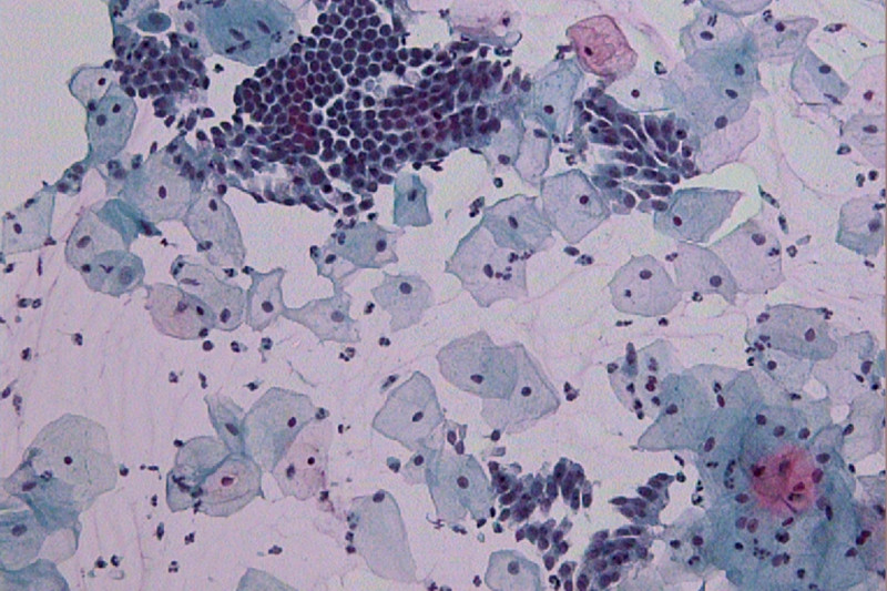 Imagem de Citologia Oncótica