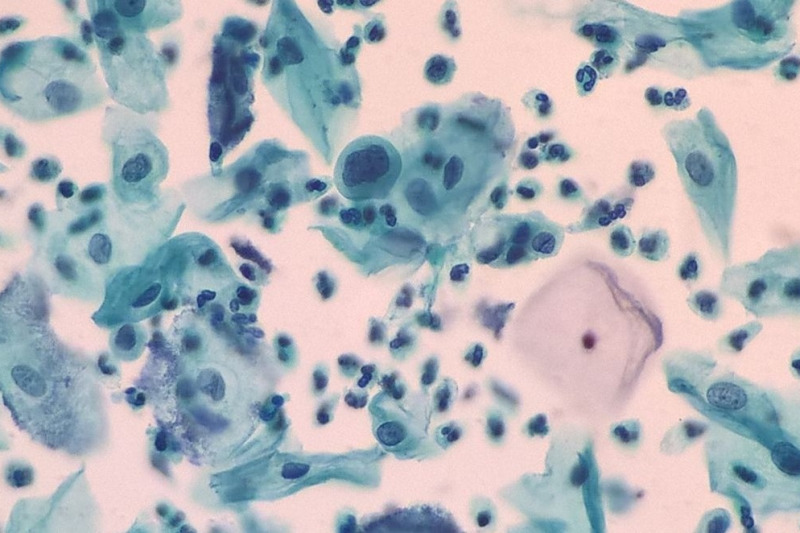 Imagem de Citopatologia