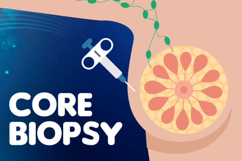 Imagem de Core Biopsy 