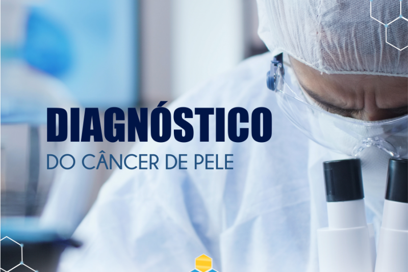 Imagem de Diagnóstico do Câncer de Pele