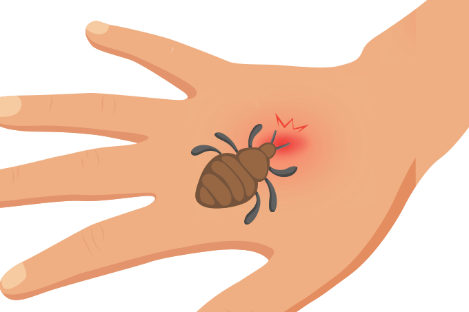 Imagem de Doença de Chagas | Pode Levar à Morte