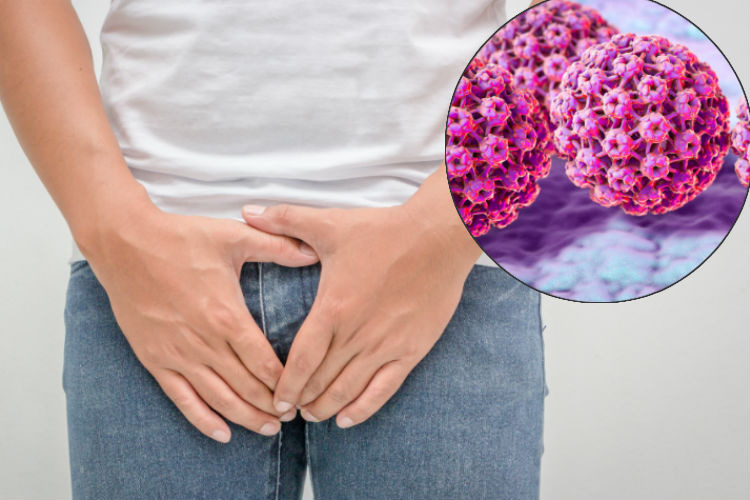 Imagem de HPV nos Homens