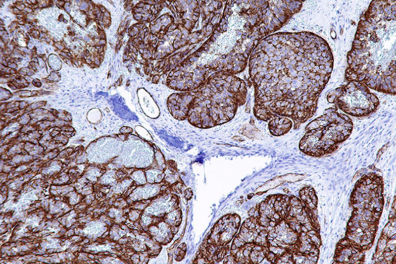 Imagem de Patologia | Imuno-Histoquímica