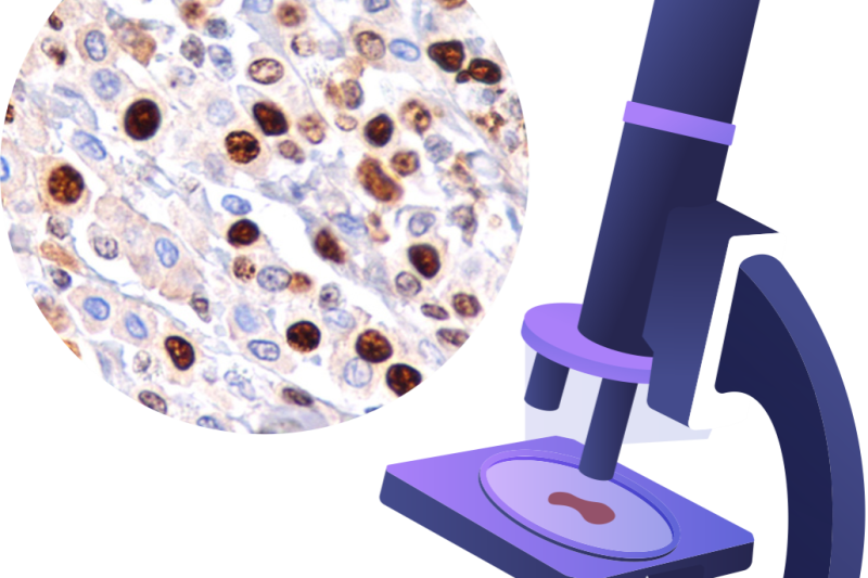 Imagem de Exame Imuno-Histoquímica 