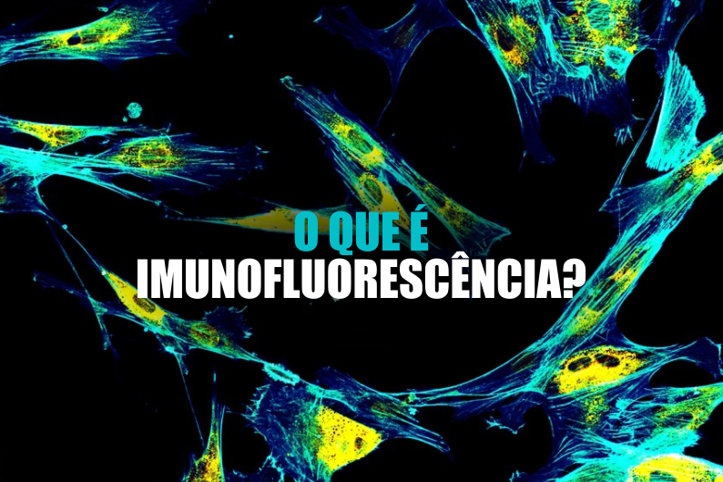 Imagem de O Que É Imunofluorescência?
