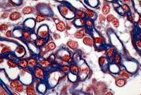 Imagem de Imunofluorescência Renal