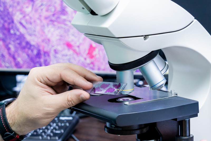 Imagem de Biópsia - Passo a Passo