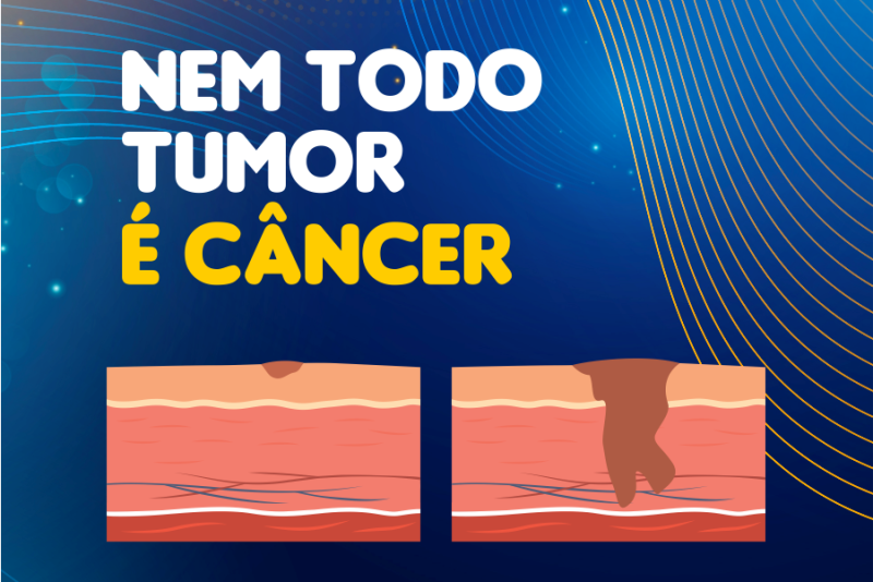 Imagem de Nem Todo Tumor é Câncer