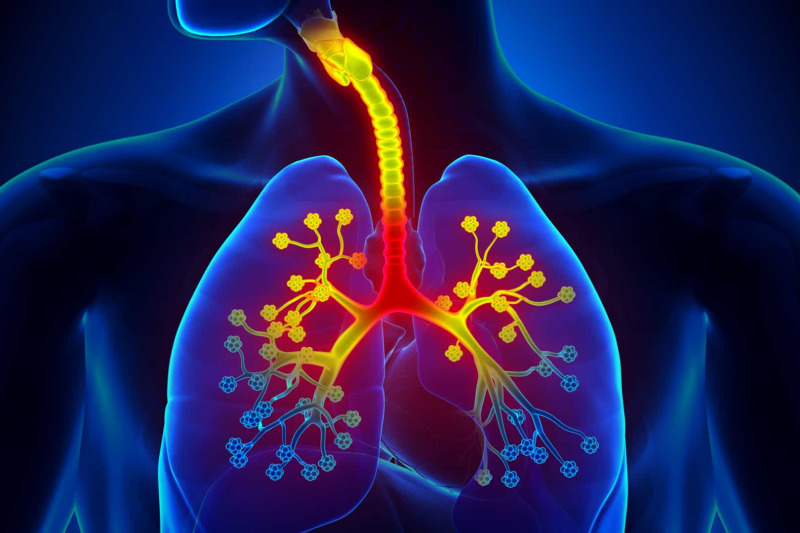 Imagem de Pneumonia | Fique Atento aos Sintomas