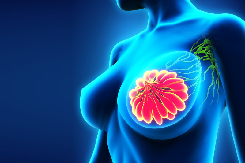 Imagem de Quando a Punção Aspirativa é Indicada?