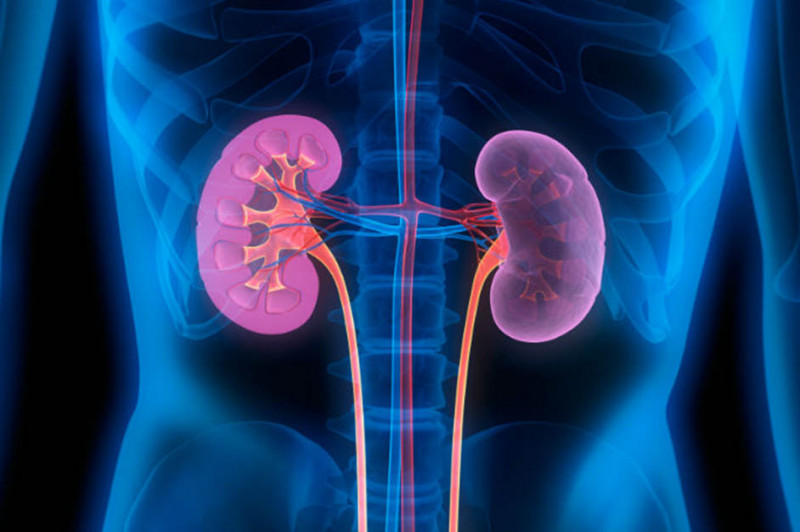 Imagem de Câncer de Rim