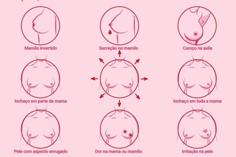 Imagem de Sinais do Câncer de Mama