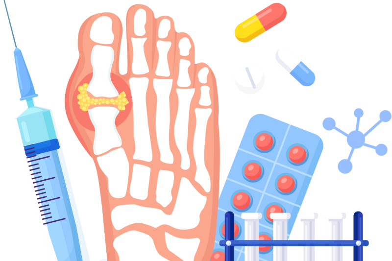 Imagem de Lesões dos Tecidos Moles