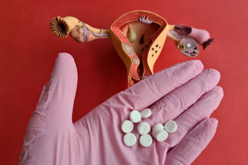 Imagem de Câncer do Colo do Útero | Diagnóstico Precoce Salva Vidas