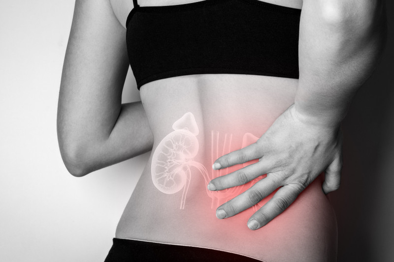 Imagem de Como é Feita a Biópsia de Rim