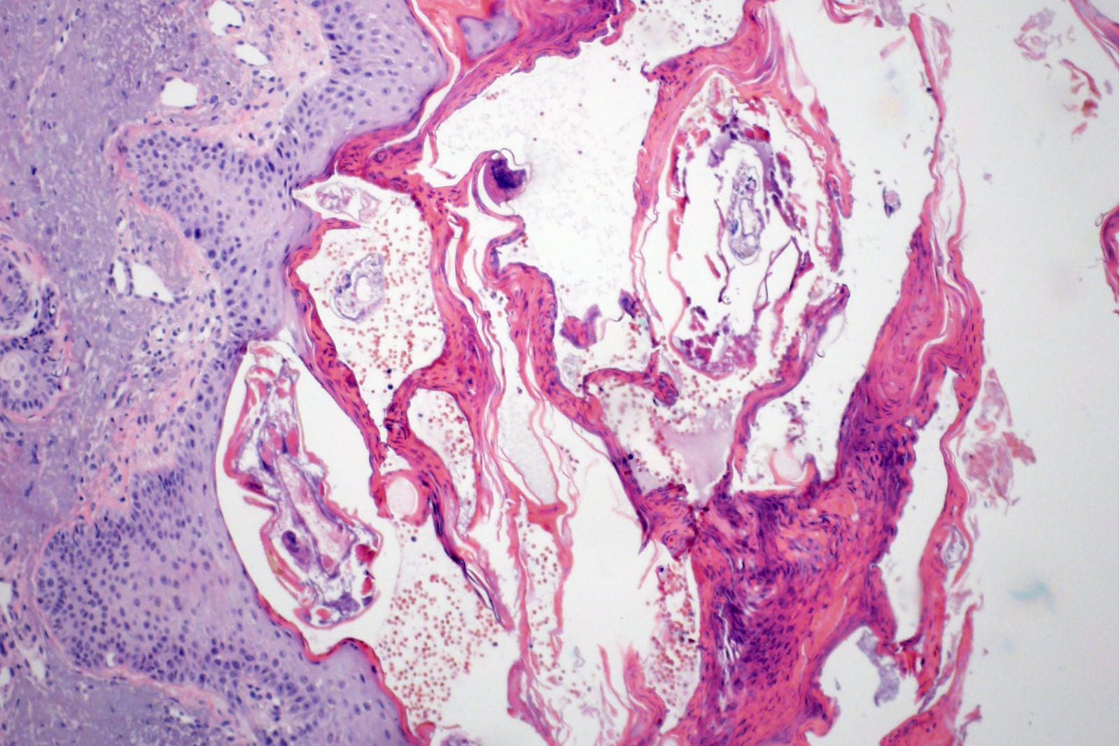 Background de Biópsias cirúrgicas simples