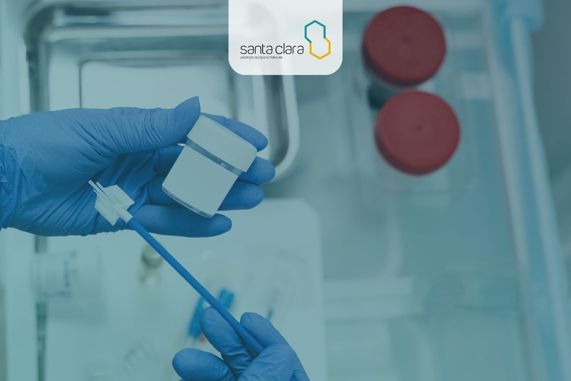 Background de Citologia Cérvico-Vaginal - Papanicolau (Convencional e em Meio Líquido)