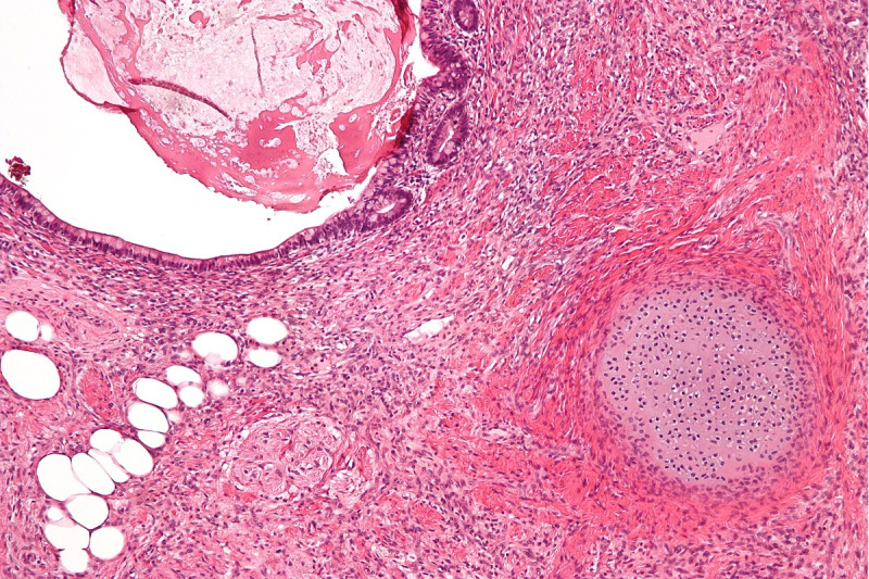Imagem de Biópsias cirúrgicas Complexas