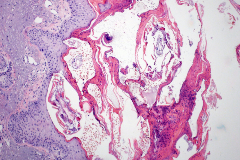 Imagem de Biópsias cirúrgicas simples