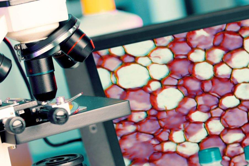 Imagem de Citologia oncótica de líquidos cavitários e escarro