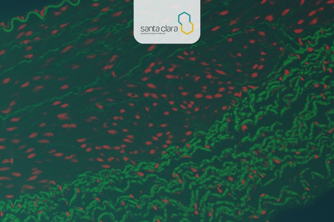 Background de Imunofluorescência