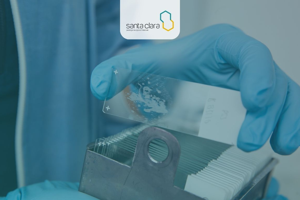 Background de Imuno-histoquímica